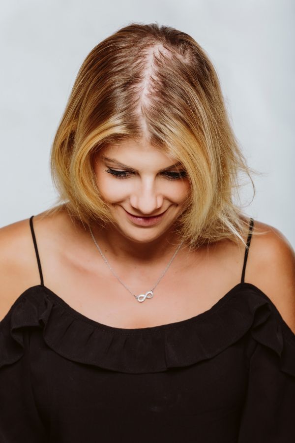 d&uuml;nnes Haar ohne Tritec-Hair<sup>&reg;</sup>