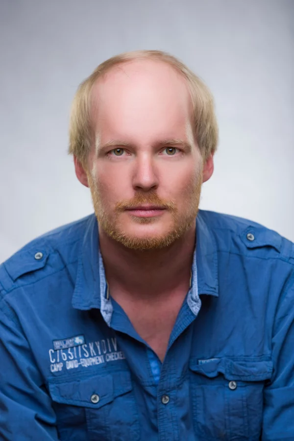 Halbglatze ohne Tritec-Hair<sup>&reg;</sup>