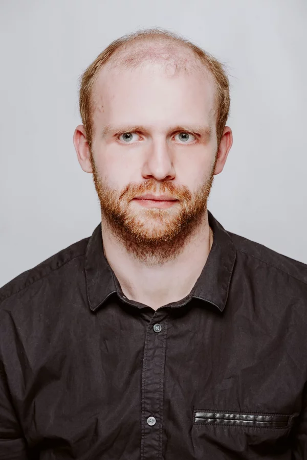 d&uuml;nnes Haar ohne Tritec-Hair<sup>&reg;</sup>